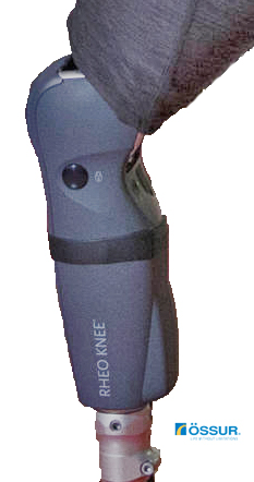 Össur Rheo Knee bionisches Prothesenkniegelenk - copyright by Oessur