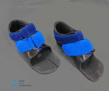 Maßanfertigung Kinderorthesen: Fußorthesen, orthopädische Maßanfertigung der Orthopädietechnik Mais