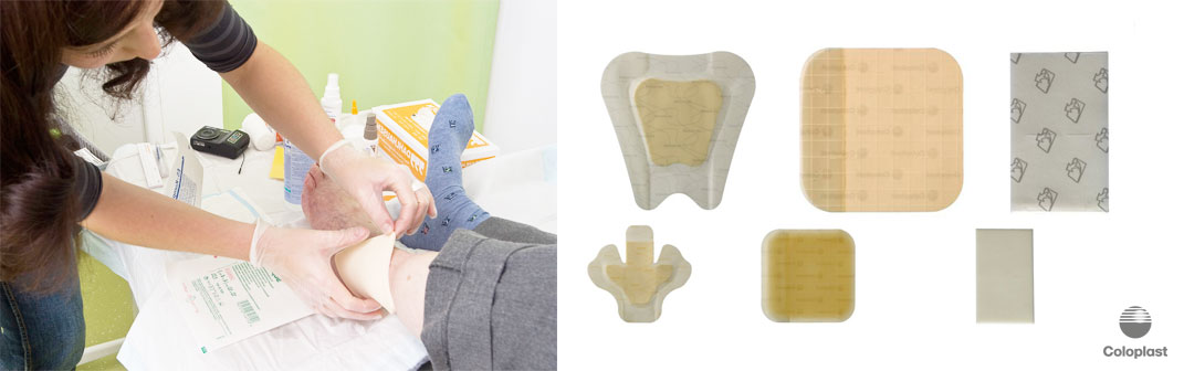 Moderne Wundversorgungsprodukte by Coloplast für eine effektivere und schneller Wundheilung. Professionelle Wundversorgunsprodukte wie Bitain und Comfeel für professionelles Wundmangement Moderne Wundversorgungsprodukte by Coloplast für eine effektivere und schneller Wundheilung. Professionelle Wundversorgunsprodukte wie Bitain und Comfeel für professionelles Wundmangement